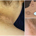 Retire esas feas manchas oscuras en el cuello, las axilas y la entrepierna aplicando esta receta casera por 15 minutos !!