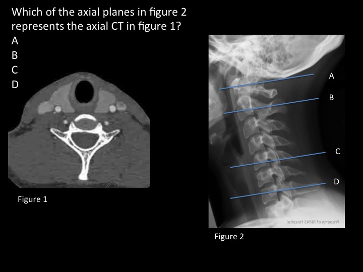 Anatomical Basis of Clinical Practice Practice Questions [Sectional