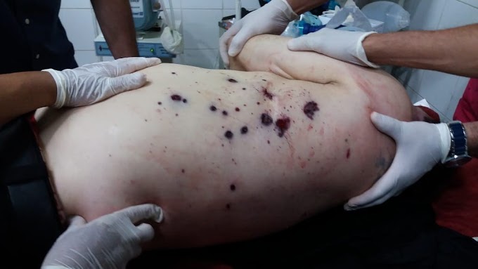Dr. Baba foi atingido com um tiro de escopeta em parte do tórax