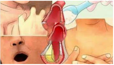 Say Goodbye to Clogged Cardiologist Arteries And Removed High Blood Pressure With Just 4 Tablespoons