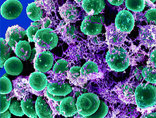 beneficial bacteria and microorganisms beneficial bacteria and microorganisms