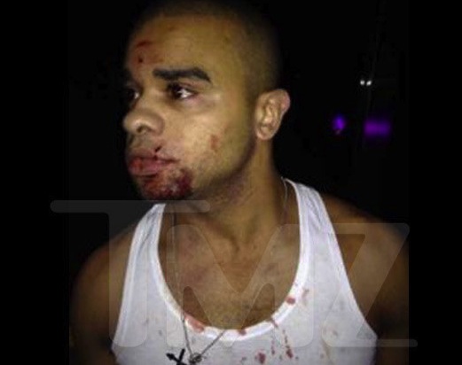 Raz-B -- ON LIFE SUPPORT ... Comatose After Bottle Attack Raz-B -- ON LIFE SUPPORT ... Comatose After Bottle Attack
