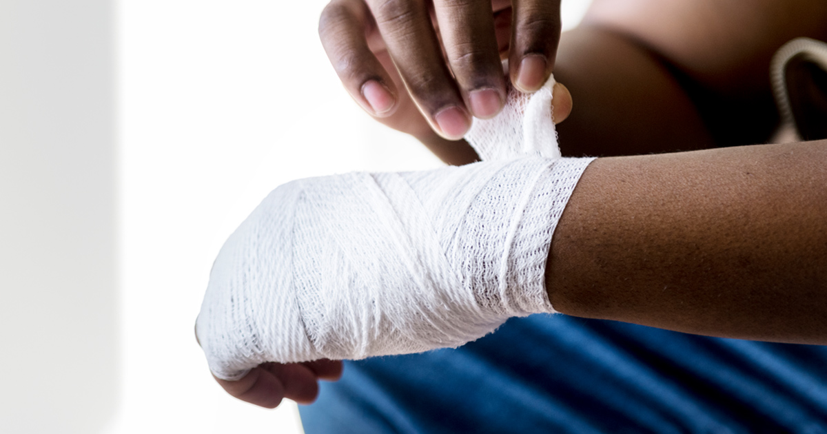 THE DO’S AND DON’TS OF TREATING BURNS Jet Club