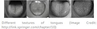 tongue structure