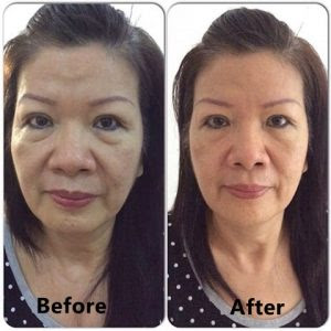 Cream Anti Aging Lokal Terbaik Cream Anti Aging Lokal Terbaik