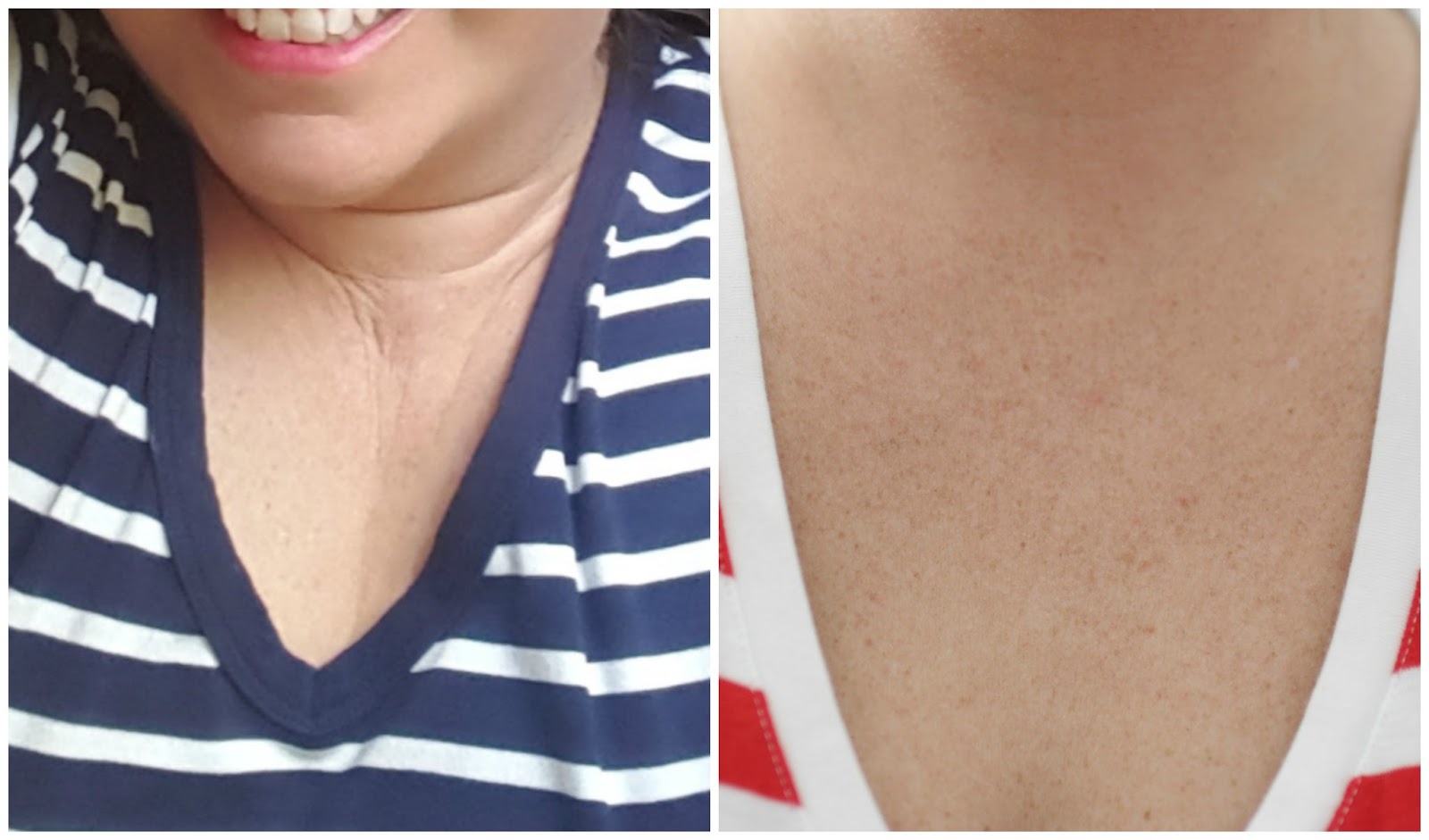 Elle Sees Beauty Blogger in Atlanta How to Get Rid of Chest Wrinkles