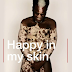 'People said I looked like a zebra' - Model with Vitiligo Bashir Aziz is Happy in his Skin
