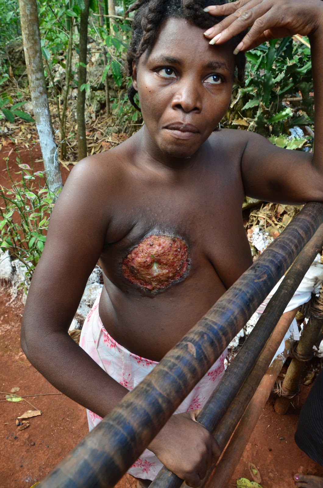 Fat Naked Female Of Haiti 4