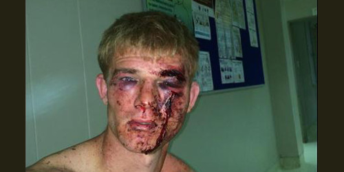 Image result for whites beaten by blacks