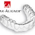 Niềng răng bằng khay clear aligner có đau không?
