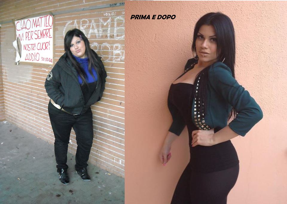 perdita di peso media dopo bypass gastrico perdita di peso media dopo bypass gastrico