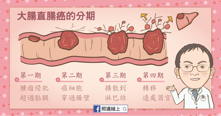 大腸直腸癌分期
