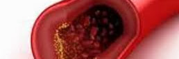 Best Natural Tips to Reduce Blood Cholesterol Level