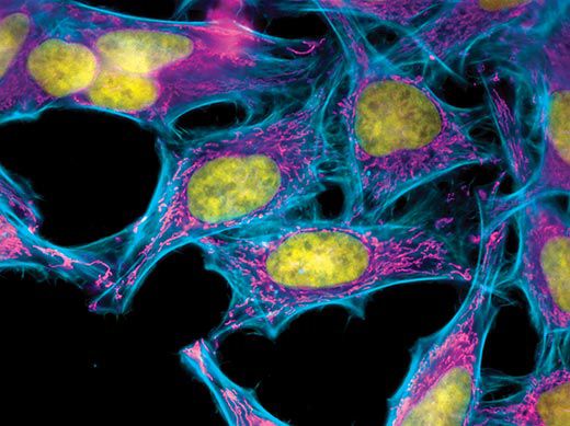 Benefits of hela cells picture