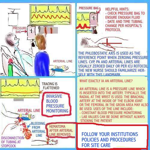 Dear Nurses HEMODYNAMIC MONITORING WHAT IS IT