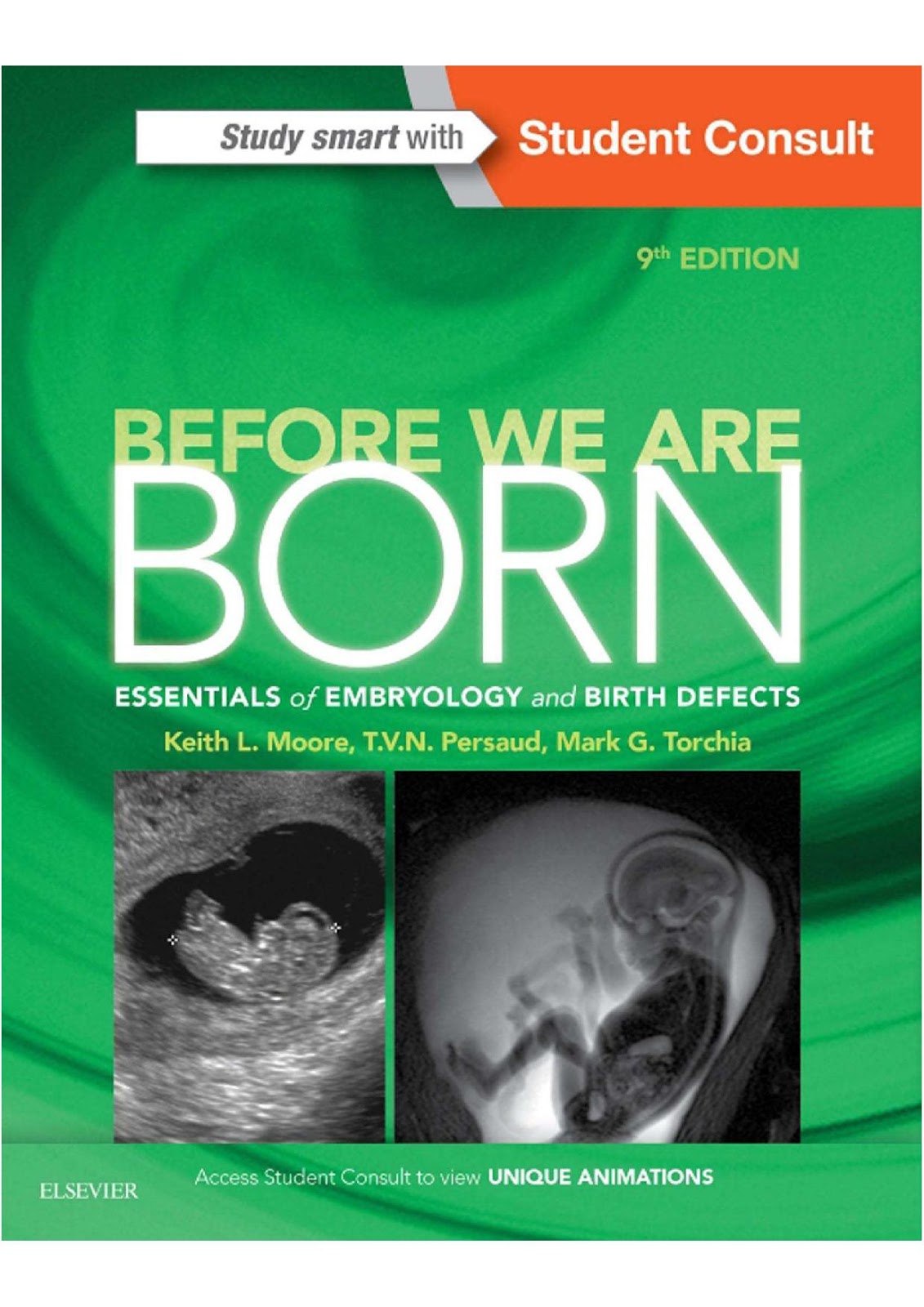 Before We Are Born Essentials of Embryology and Birth Defects, 9th Edition Bác Sĩ Võ Tá Sơn Before We Are Born Essentials of Embryology and Birth Defects, 9th Edition Bác Sĩ Võ Tá Sơn