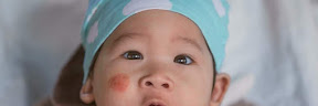 Ruam Merah di Pipi Bayi Bukan Eksim Susu Akibat Ketumpahan ASI Saat Menyusu
