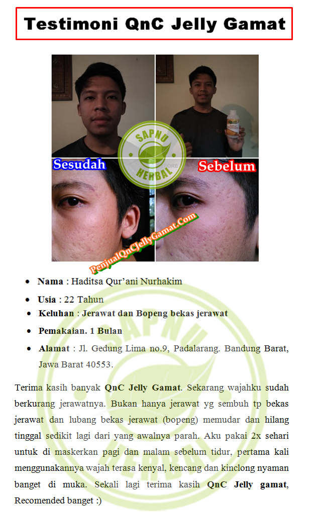 Cara Mengatasi Kulit Wajah Belang Dan Kering yang Terbukti Mujarab ~ TESTIMONI QNC JELLY GAMAT Cara Mengatasi Kulit Wajah Belang Dan Kering yang Terbukti Mujarab ~ TESTIMONI QNC JELLY GAMAT