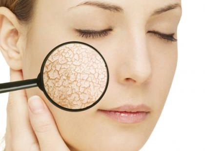 Tips hướng dẫn cách chăm sóc da mặt vào mùa hanh khô Tips hướng dẫn cách chăm sóc da mặt vào mùa hanh khô