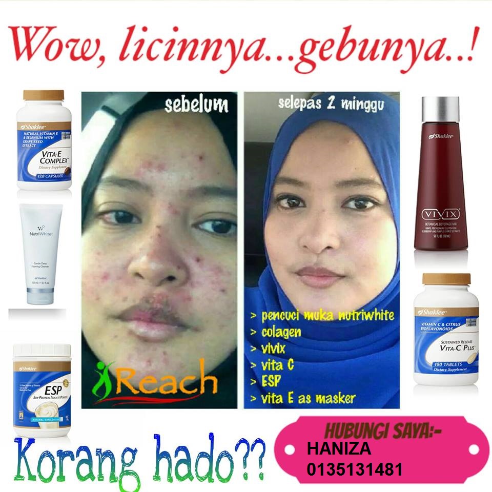 Pengedar Shaklee Klang Dan Banting 0135131481 Vitamin Untuk Kulit