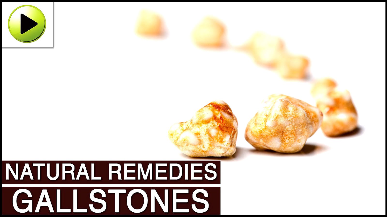 Gallbladder Pain Treatment Home Remedies Medi Choices