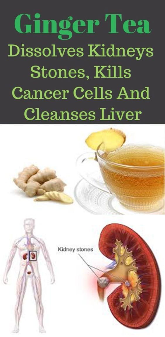 GINGER TEA DISSOLVES KIDNEYS STONES, KILLS CANCER CELLS AND CLEANSES