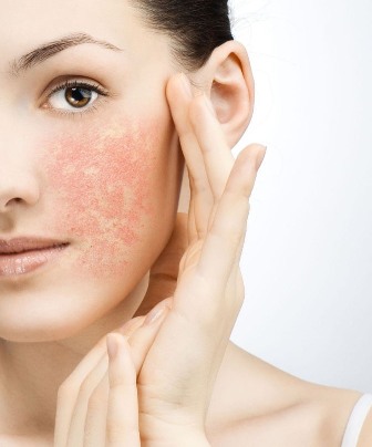 apa itu kulit kombinasi sensitif