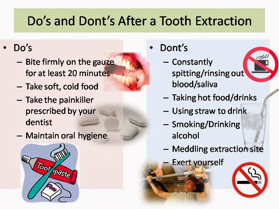 FAMILY CARE DENTAL: Do's and Dont's After Tooth Extraction