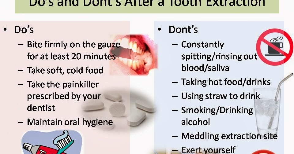 How Long To Keep Gauze In After Molar Extraction Post Surgery