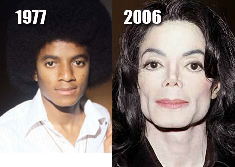 michael-jackson-1977-2006-awfl-p-surg-dot-com.jpg