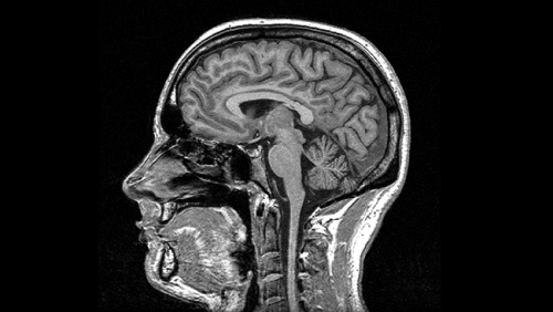 Prinsip kerja MRI (Magnetic resonance imaging ) - myrightspot.com