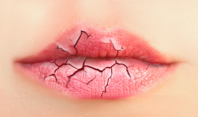 Cara Mengatasi Bibir Kering Dengan Bahan Alami  Healtinfon