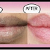 10 MINUTES, 2 INGREDIENTS AND YOUR LIPS WILL BECOME PINK NATURALLY, THIS REMEDY WORKS EVEN FOR DARK BLACK LIPS TOO!