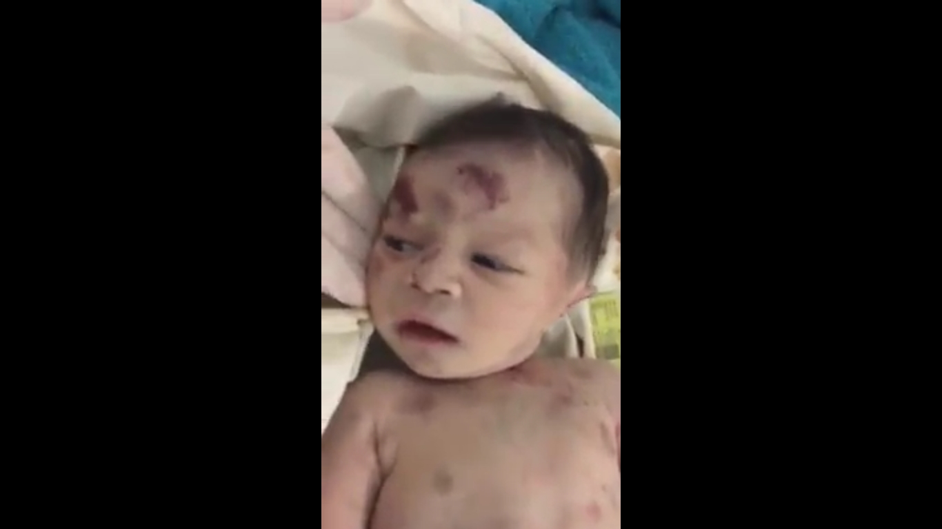 Blog do Tidi: (Vídeo) Mãe tenta matar filha recém-nascida, jogando-a