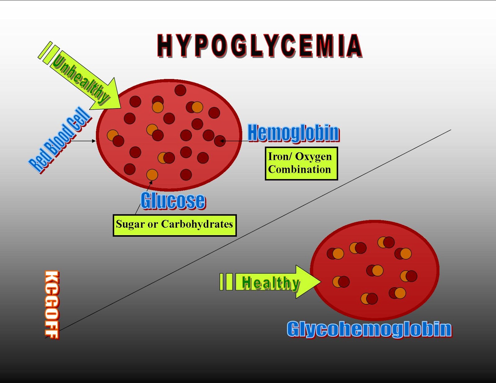 Hypoglycemia System Disorder Template