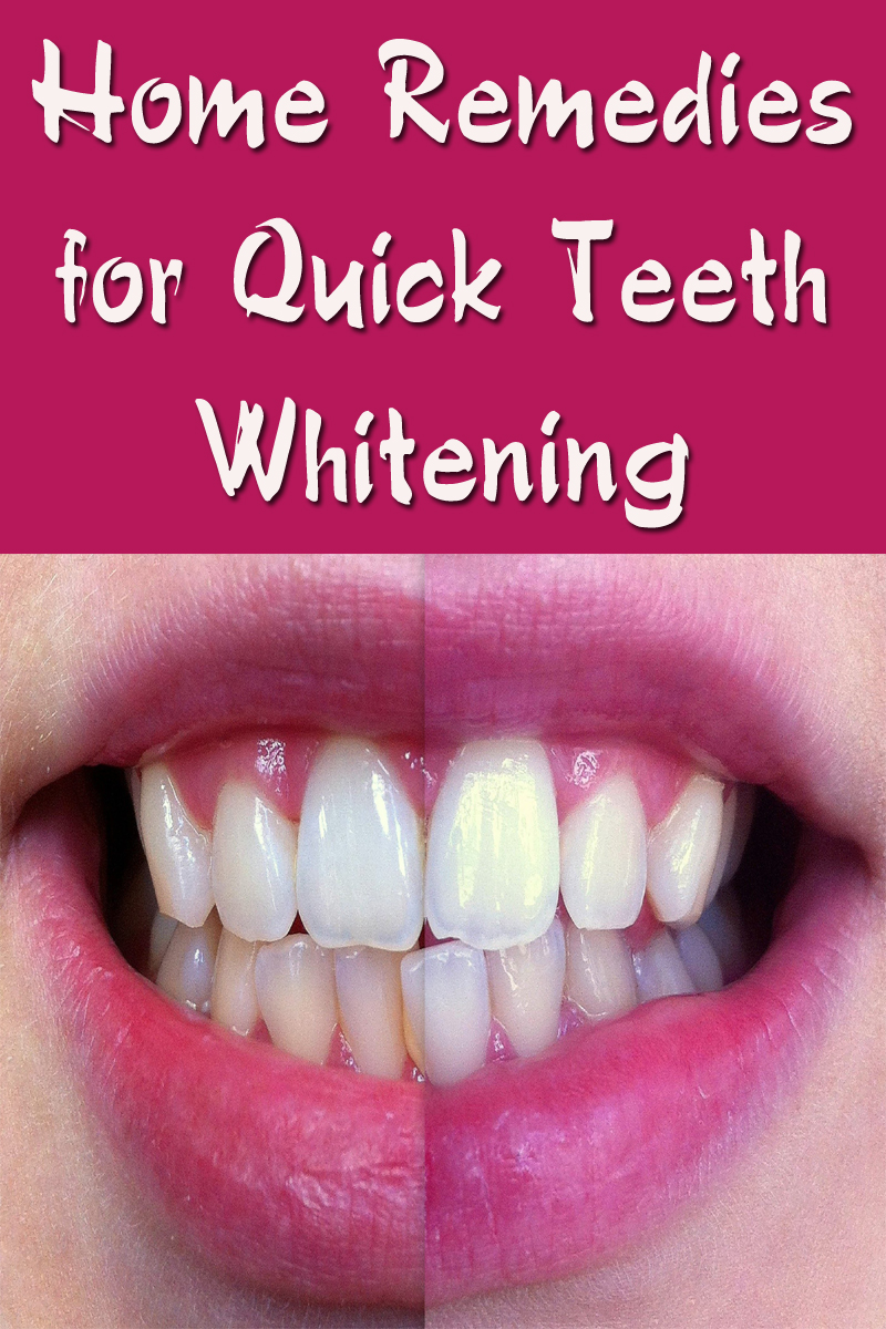 Home Remedies for Quick Teeth Whitening Fit Result
