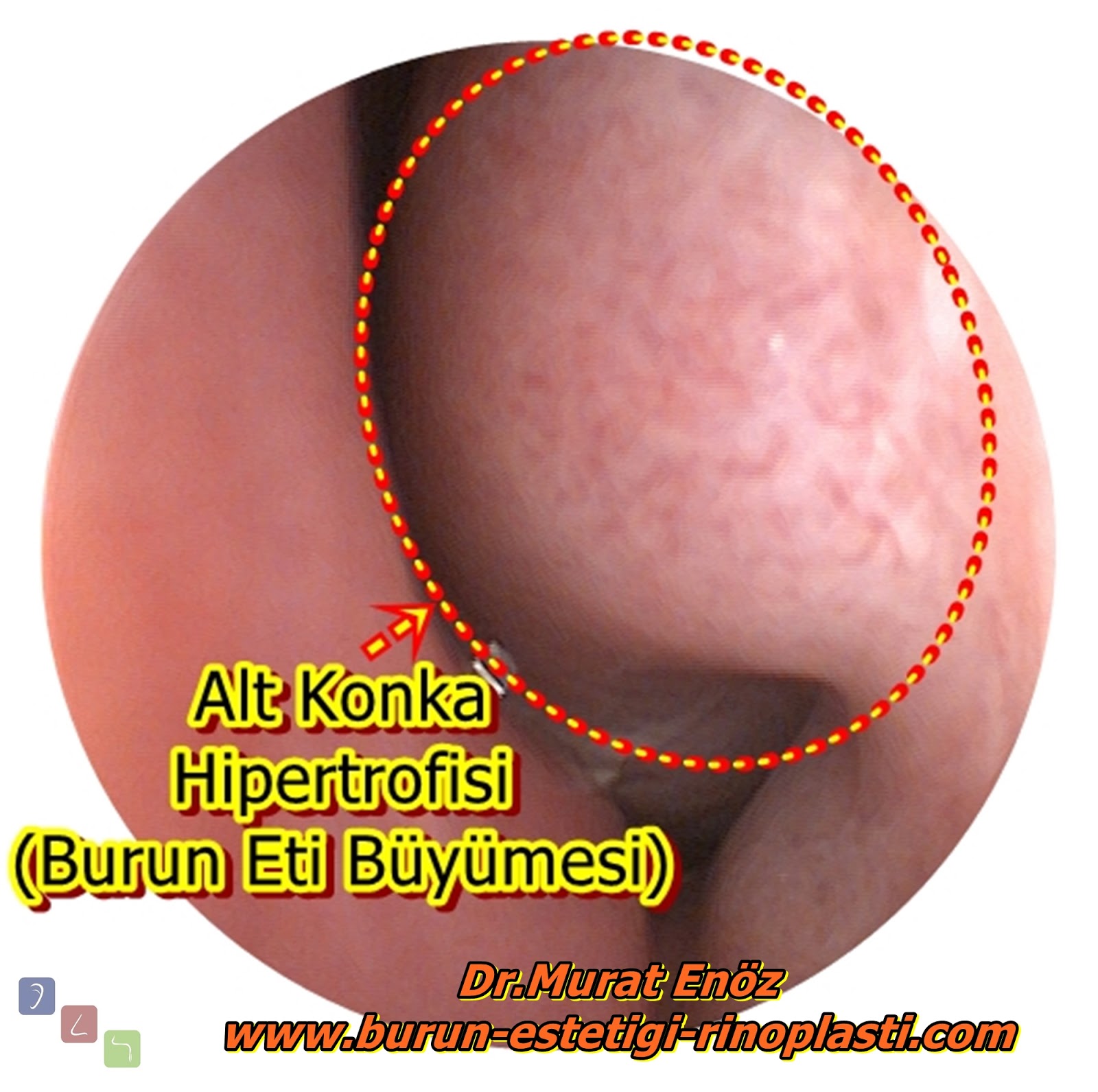 Burun Etleri İle İlgili Farklı Bilgiler