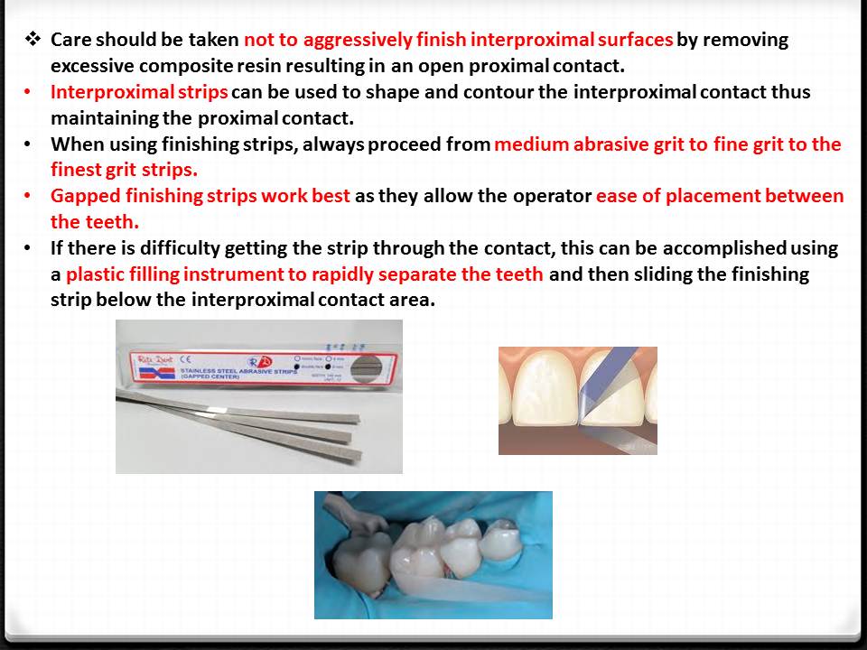 DOs and DONTs in DENTISTRY Polishing Composite Restorations EASY