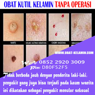 obat kutil - di kulit kemaluan kelamin, penis pria laki-laki, vagina luar dan dalam, perempuan wanita Ibu hamil menyusui mengandung, obat penghilang kutil menghilangkan kutil tanpa operasi yang terbukti dan aman terpercaya, obat penghilang kutil di kelamin, anus dubur, paha dsb