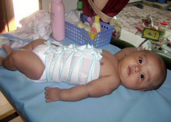 Bayi 2000