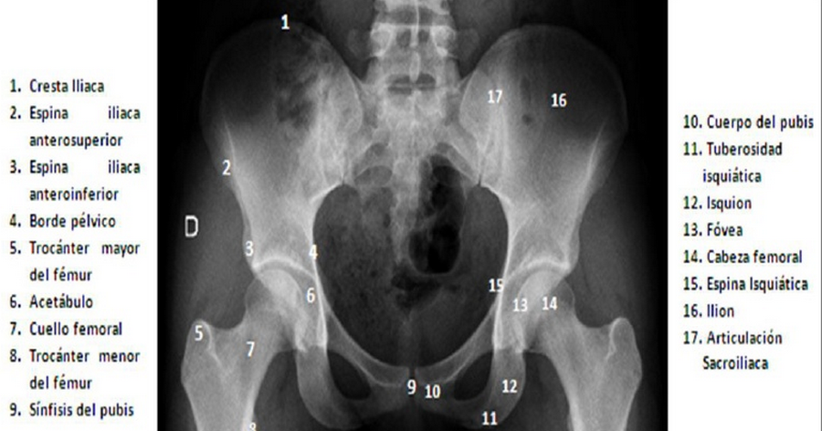 Anatomía Radiológica Abdomen Y Pelvis Radiología La Pelvis