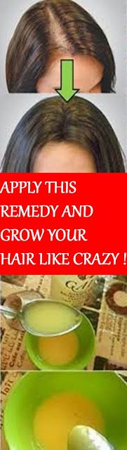 Grow Hair With These Home Remedy That Even The Doctors Did Not Know