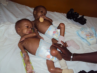 Rescatan dos niños gravemente desnutridos en Pedernales