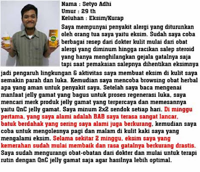 Cara Mengobati Pemfigus Vulgaris Secara Alami Cara Mengobati Pemfigus Vulgaris Secara Alami