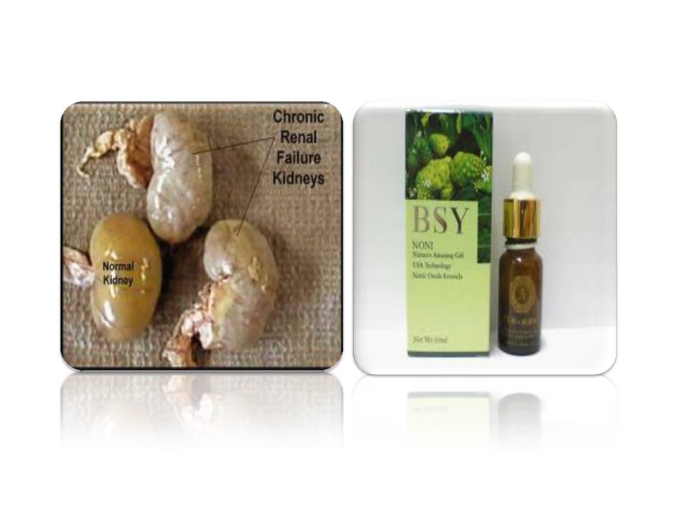 Expert Solutions Tips and Advice for Young Indians India ROLE OF