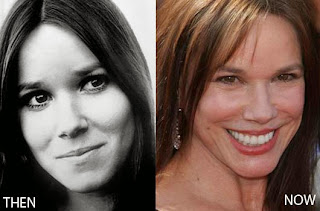 Barbara Hershey Plastic Surgery Before and After Photo