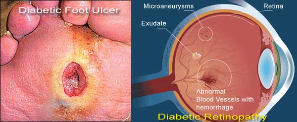 research report at ulcers research paper on ulcers