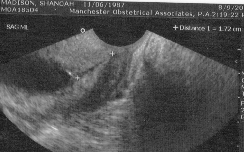 Baby Delaney s Blog Silly Cervix baby-delaney-s-blog-silly-cervix