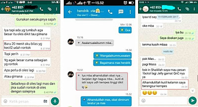 Cara Menghilangkan Skin Tag Atau Daging Tumbuh Di Kulit Leher Cara Menghilangkan Skin Tag Atau Daging Tumbuh Di Kulit Leher
