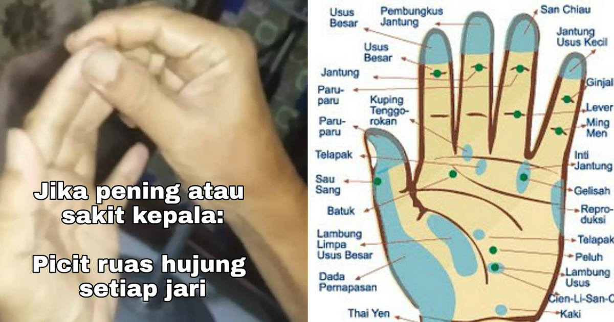 Urutan Untuk Sakit Kepala / Petua : Mengatasi masalah sakit kepala Once